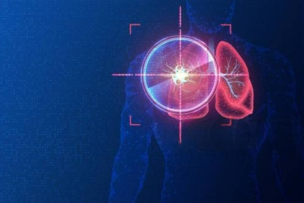 Immunotherapy & Targeted Therapy