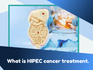 HIPEC Cancer Treatment