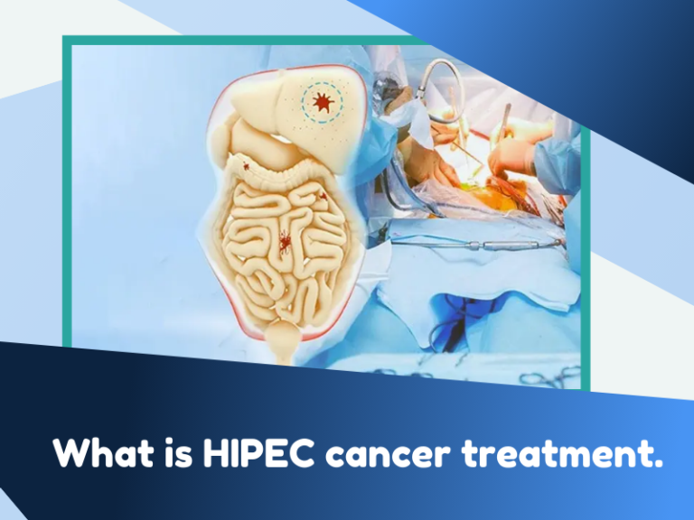 HIPEC Cancer Treatment